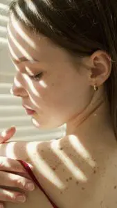 A woman with freckles in her back shoulder